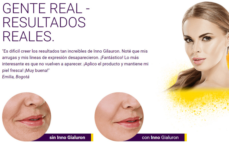 La crema lifting Inno Gialuron ayuda a mejorar la circulación sanguínea